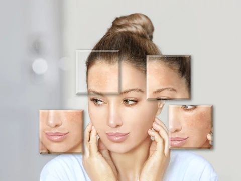 Így határozd meg bőrtípusod!